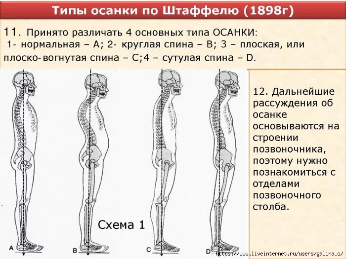 Нарушение осанки огэ. Виды осанки по штаффелю. нарушение осанки по штаффелю. типы осанки человека. типы искривления осанки.