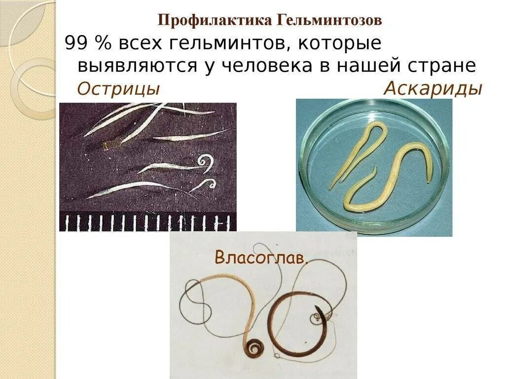 Как вывести аскарид у ребенка. Паразиты черви аскариды у детей симптомы. аскарида профилактика гельминтозов.