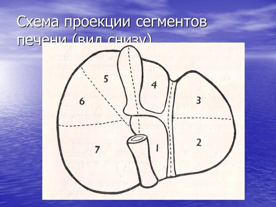 Сегменты печени на УЗИ схема. Сегменты печени анатомия. Сегменты печени по УЗИ схема. Сегменты печени на кт схема. Узи печени схема