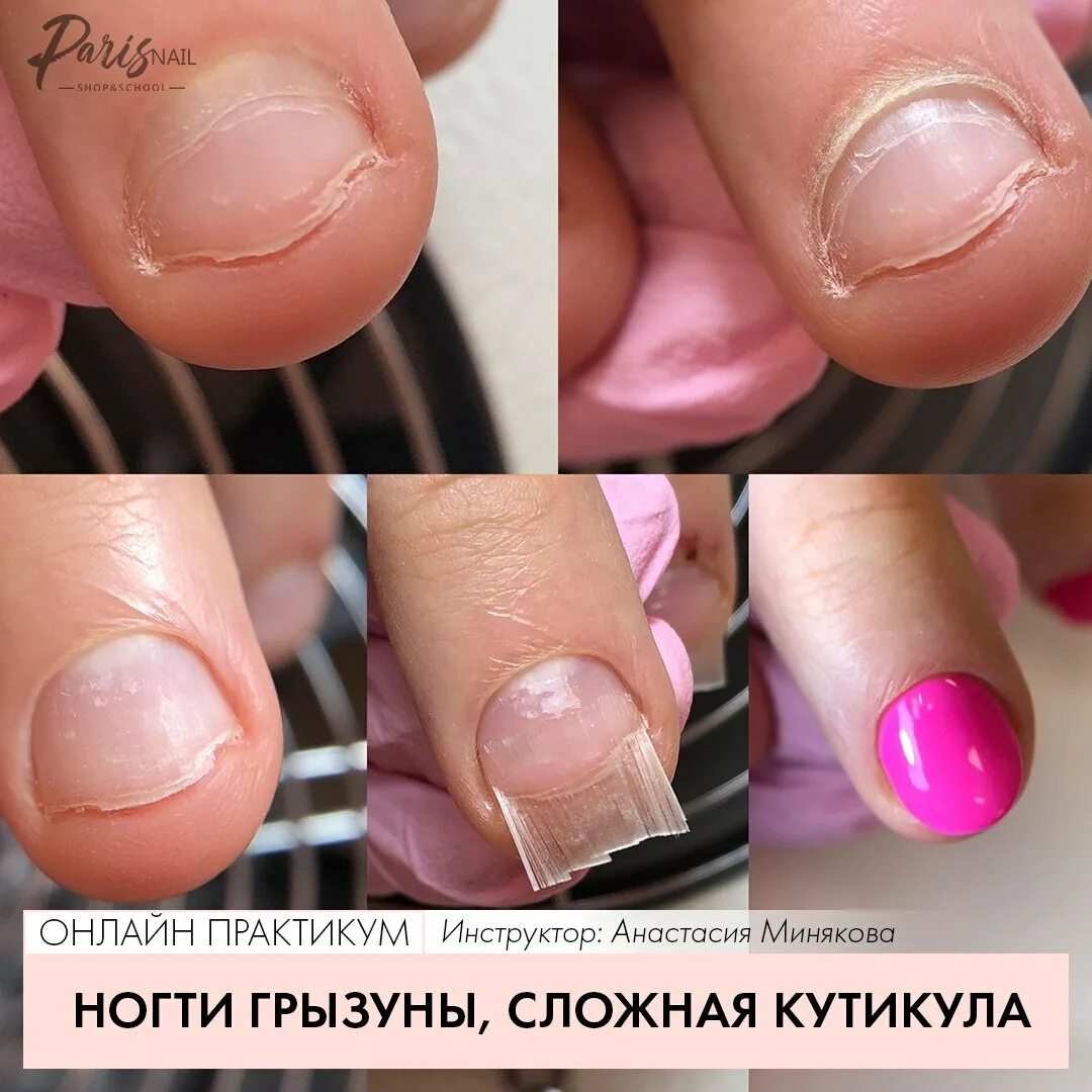 Тип кутикулы. Тип кутикулы