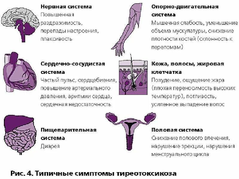 Гипертиреоз щитовидной железы. Тиреотоксикоз презентация. Гипертиреоз презентация.