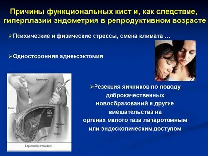 80 причины