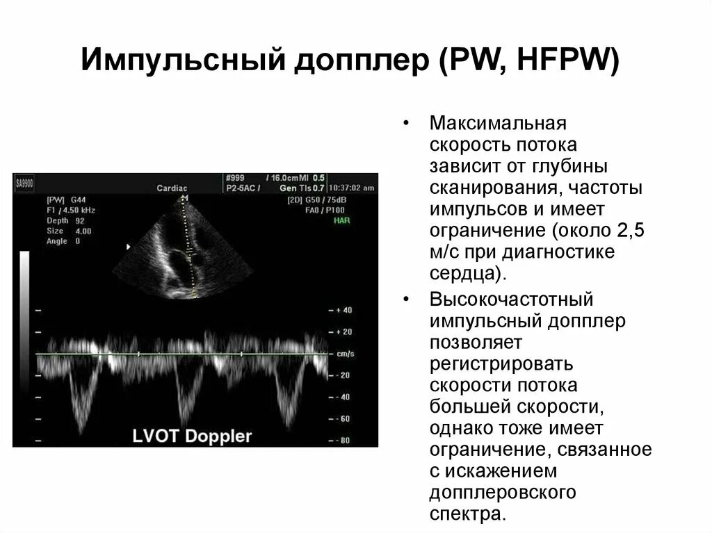 Пульсирующий режим
