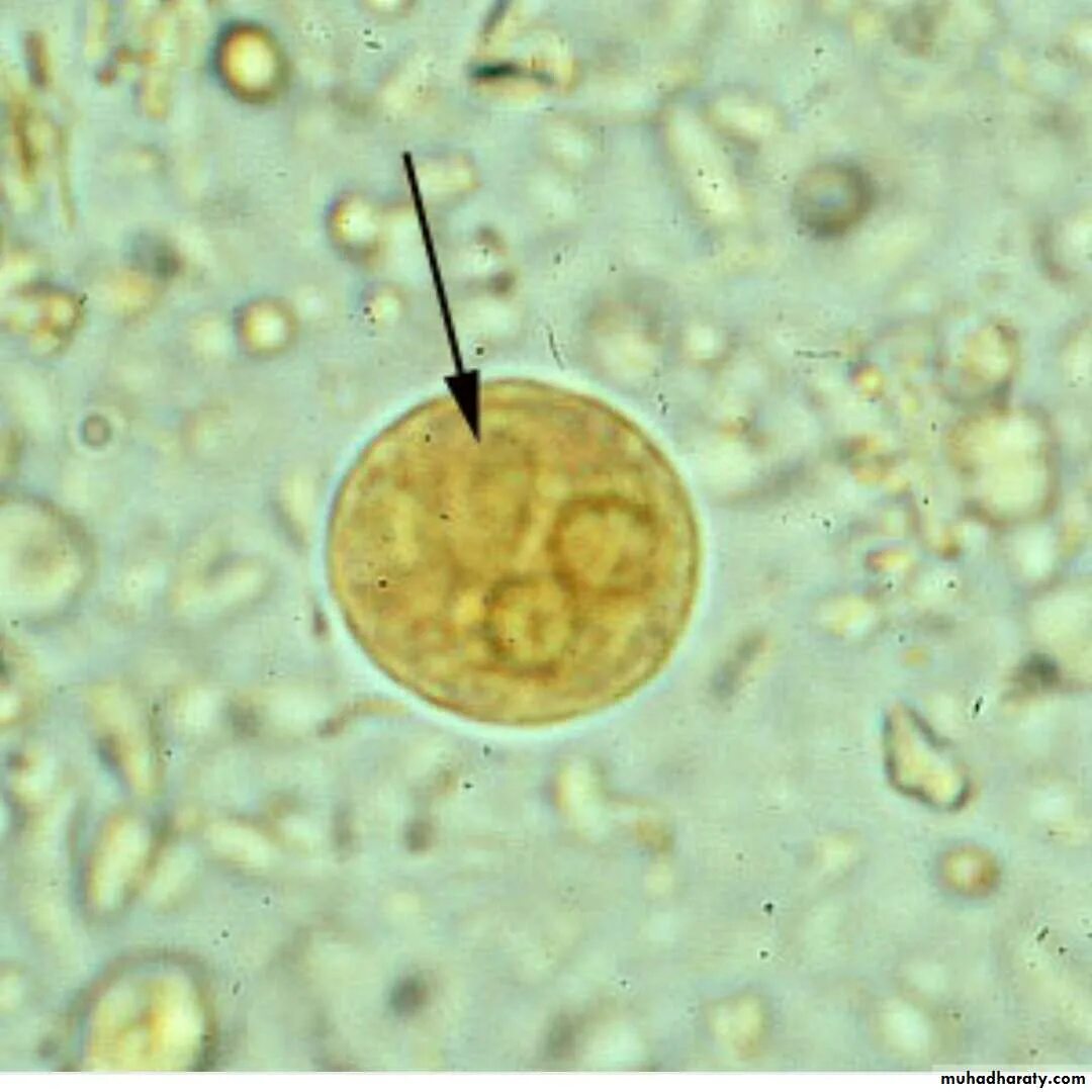 Цисты Entamoeba. Цисты лямблии микроскопия. Цисты лямблий микроскопия. Микроскопия кала цисты амеба. Entamoeba coli в кале