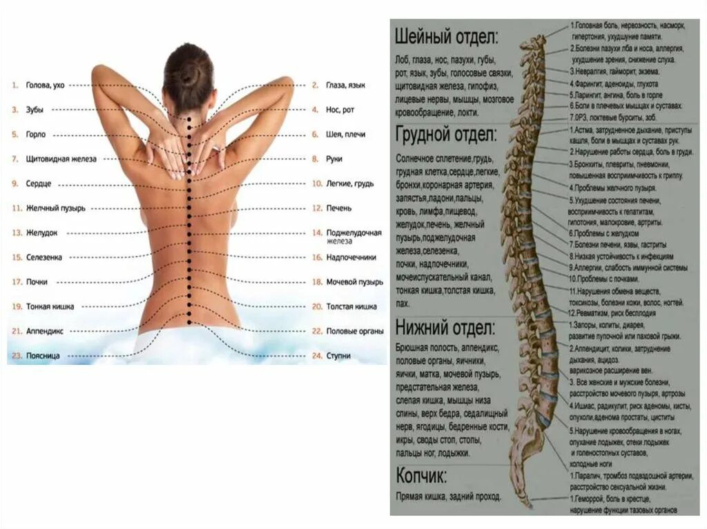 Болезни спины и позвоночника. Самый низ позвоночника. Психосоматика позвоночник. Болит внизу позвоночника. Хвост у человека позвоночник патология.