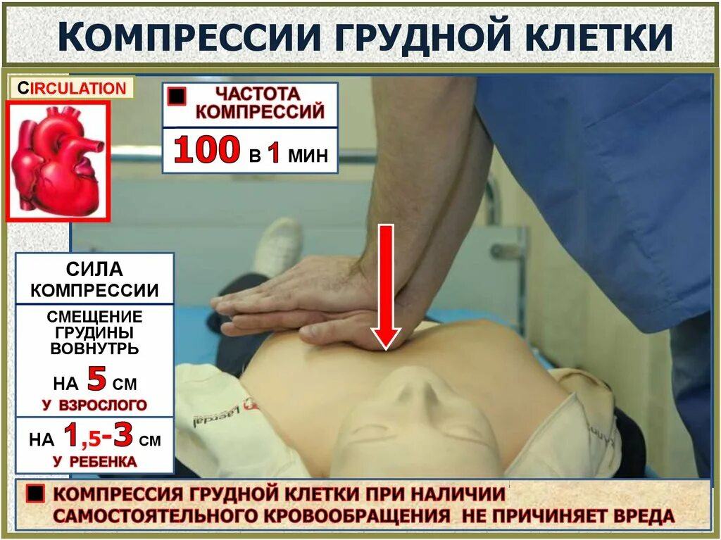 Частота надавливания при проведении массажа сердца. Порядок выполнения наружного массажа сердца. Компрессии грудной клетки при слр. Частота нажатий на грудную клетку при непрямом массаже сердца. При сжатие сердца у взрослых.