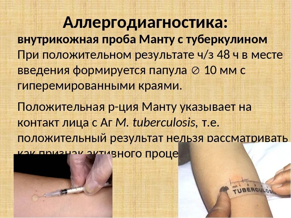 Манту через сколько после болезни можно делать