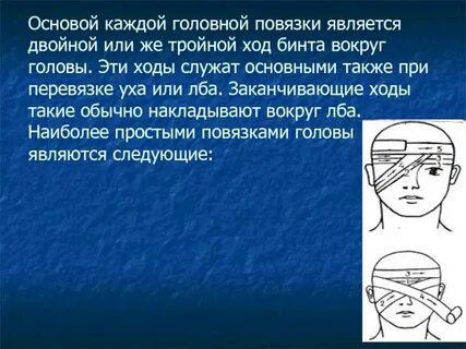 Фиксирующие ходы повязки