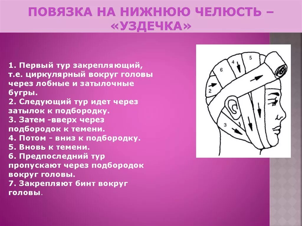 Уздечка алгоритм наложения. Наложение повязки уздечка алгоритм. наложение повязки на голову уздечка. технику наложения повязки «уздечка».. продемонстрируйте технику наложения повязки «уздечка»..