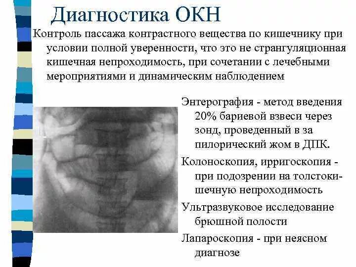 Неопухолевая кишечная непроходимость. Кишечная непроходимость факультетская хирургия. кишечная непроходимость узи протокол. острая кишечная непроходимость диагностика. методы диагностики кишечной непроходимости.