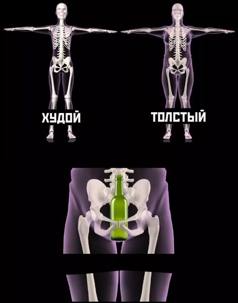 Широкая кость. Скелет с широкой костью. Скелет человека с широкой костью. Шутки про широкую кость.
