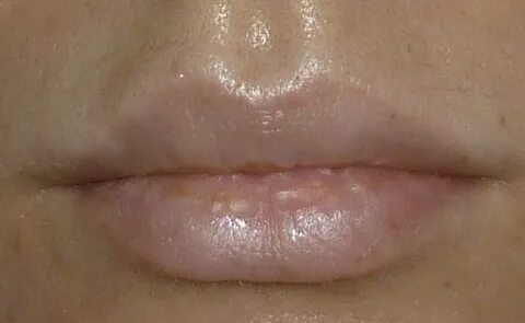 Ер адам мас күйінде ер адамға соққы берді.