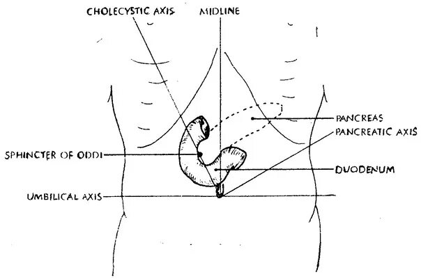 Сфинктер Одди расположение на теле человека. Сфинктер Одди топография. Точка проекции сфинктера Одди. Схема расположения сфинктера Одди.