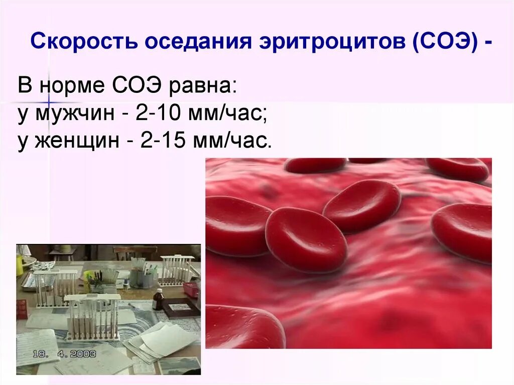 Соэ 8 мм. Скорость реакции оседания эритроцитов норма. Механизм СОЭ В крови. СОЭ эритроцитов. Скорость оседания эритроц.