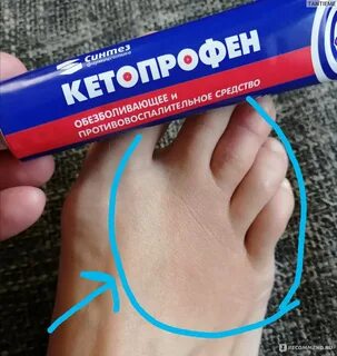 Ушиб отзывы