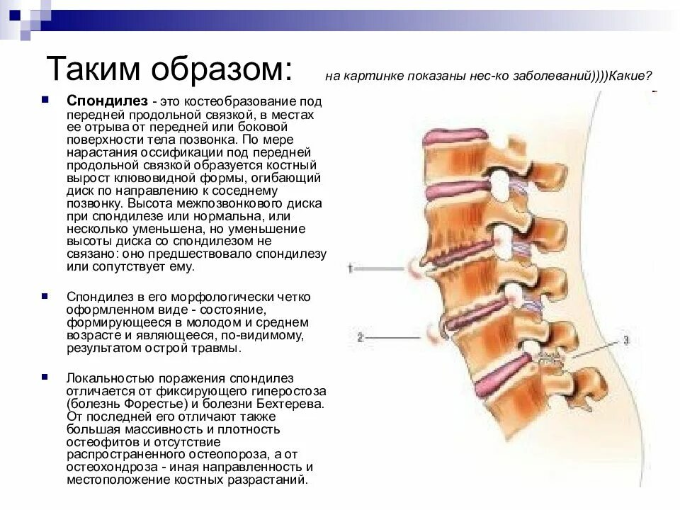 Дистрофические изменения позвоночника. Дегенеративно-дистрофические изменения позвоночника на кт. Остеохондроз s1 s2 позвонка. Дегенеративно дистрофические изменения грудного отд позвоночника. Дистрофические изменения позвоночника грудного отдела 1-2 степени.