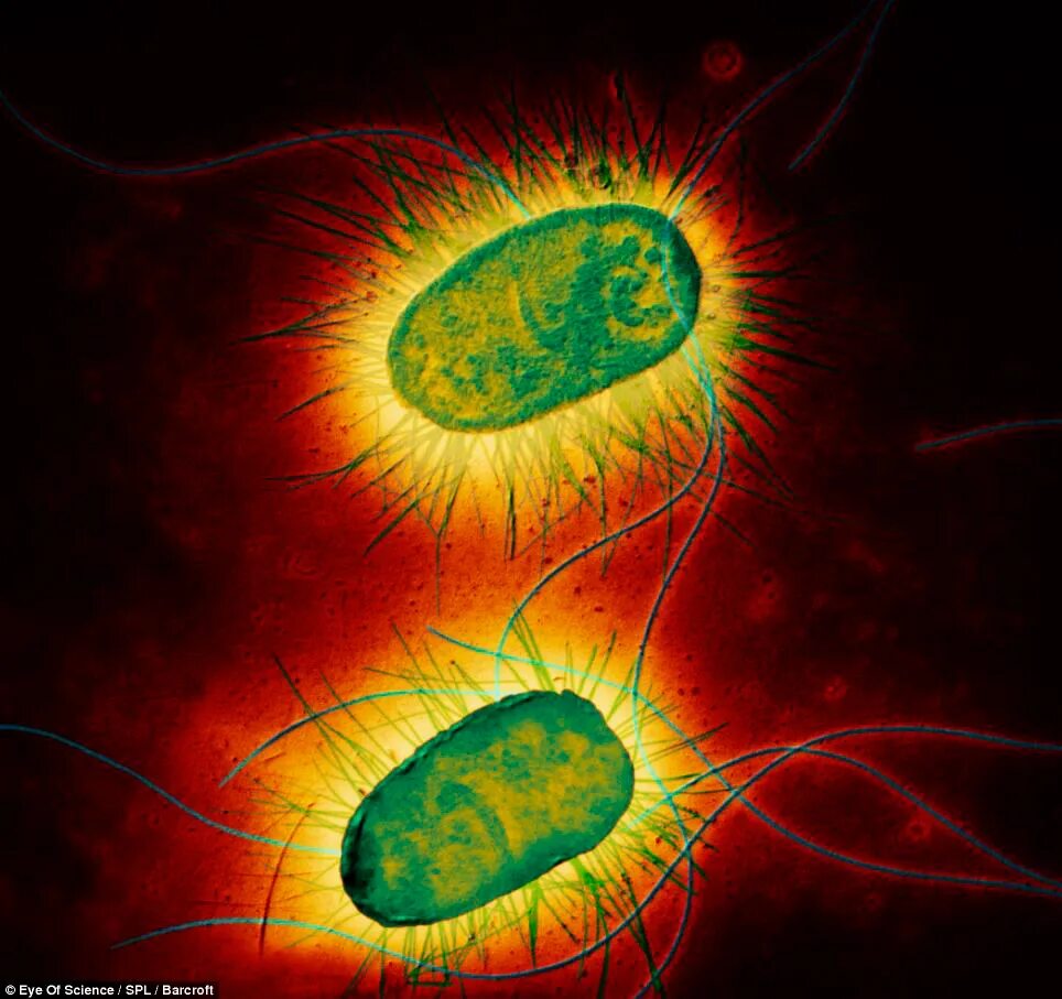 Микробы вирусы бактерии. Микробы бактерии вирусы под микроскопом. E coli под микроскопом. Вирусы под микроскопом. Микроорганизмы вирусы под микроскопом.