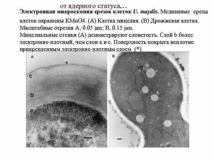 Клеточная стенка грибов хитин. Микрофотография грибной клетки. Структура клеточной стенки гриба. Клетка гриба стенка. Грибные стенки покрыты снаружи клеточными стенками образованными