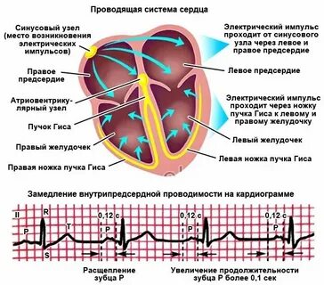 Нарушение проводящей системы