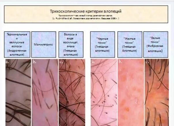 Типы кожи головы под микроскопом. Состояние кожи головы и волос. Нормальная трихоскопия. Анализ состояния кожи головы.