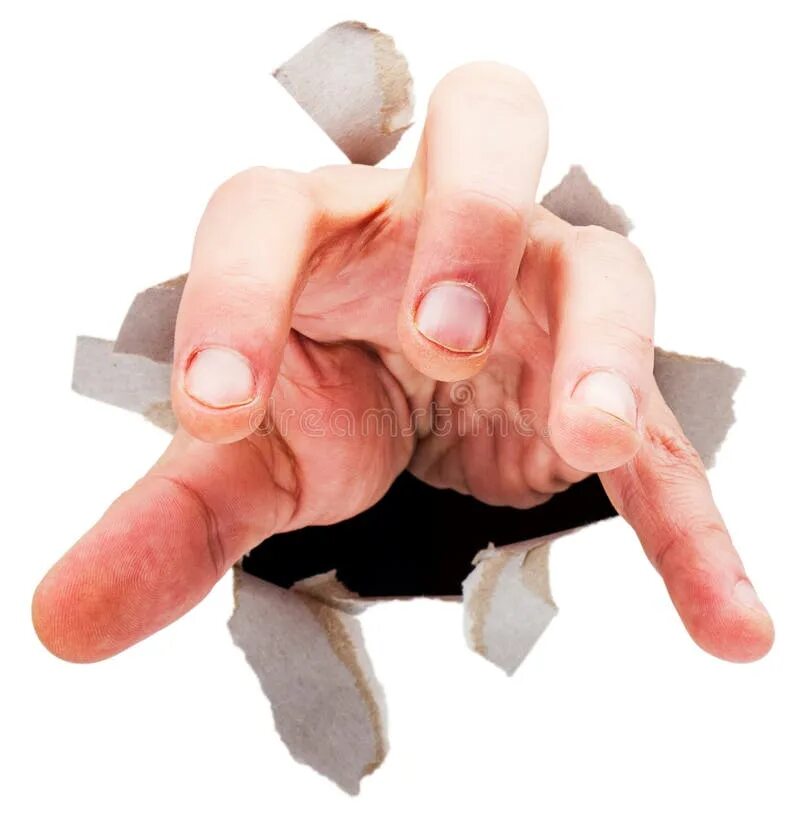 Рука ломает 4 стену. Broken person. Broken handed. Broken handed. Cast гипс.