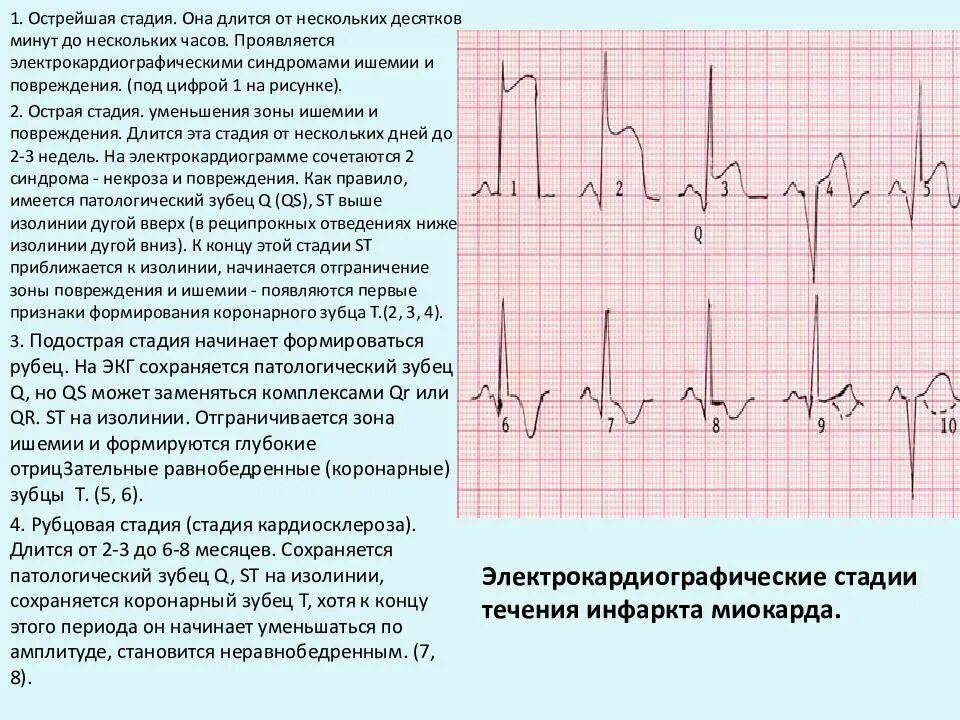 Выраженные изменения