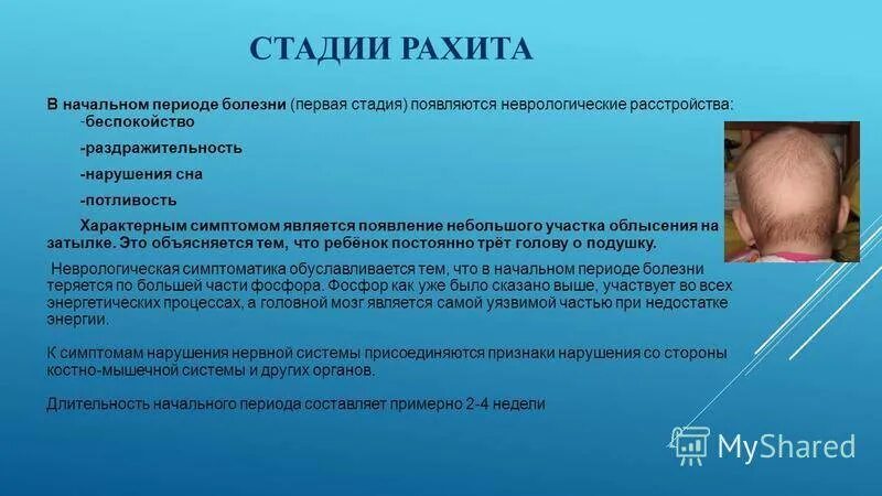 При каком витамине развивается рахит. Клинические проявления рахита. клиническое проявление начального периода рахита.