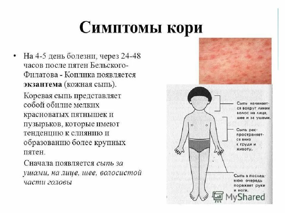 Реакция на прививку от краснухи. Первые элементы сыпи при кори. Краснуха корь скарлатина сыпь. Первые элементы сыпи при кори у детей.