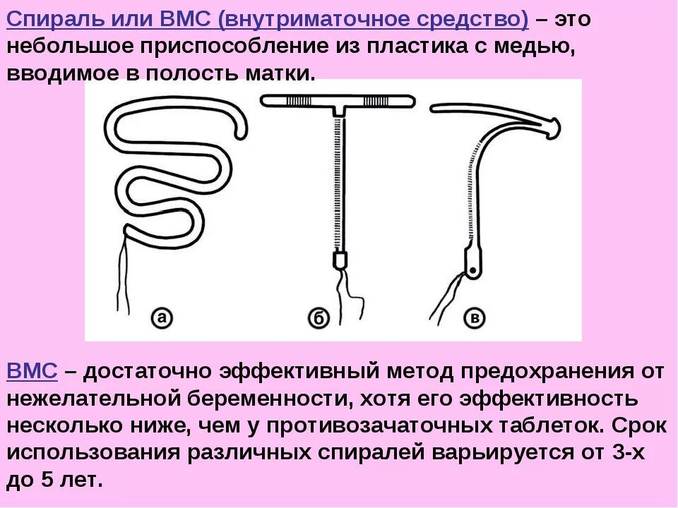 Методы контрацепции внутриматочная спираль. ВМС спираль петля Липпса. Внутриматочная спираль методы контрацептивов. Типы внутриматочных спиралей.