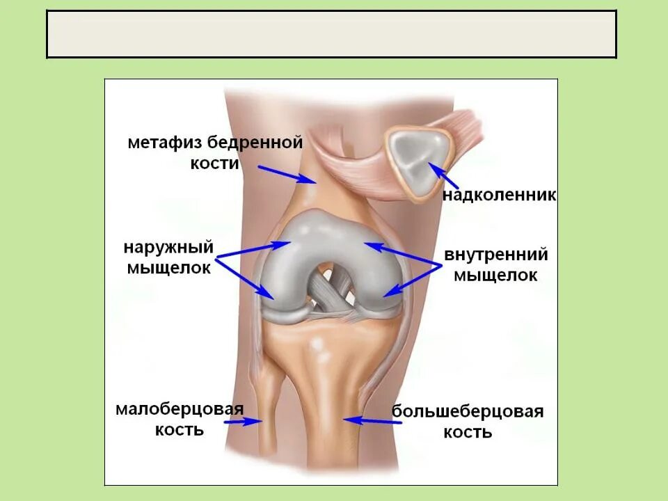 Повреждение медиального мыщелка