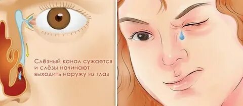 Заложило нос текут слезы