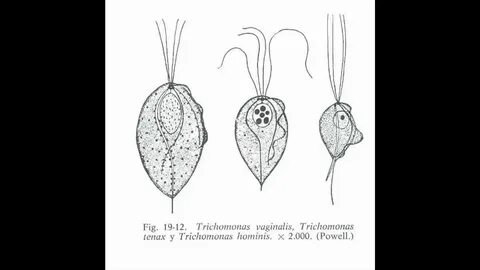 Trichomonas vaginālis