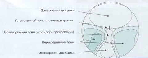 Прогрессивное зрение