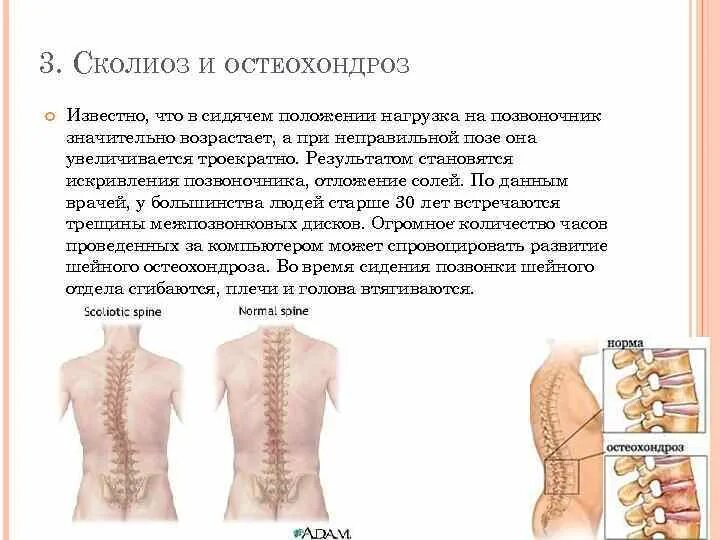 Остеохондроз, сколиоз шейного отдела. Левосторонний сколиоз 1 степени шейного отдела. Сколиоз и остеохондроз грудного отдела. Сколиоз и остеохондроз позвоночника.