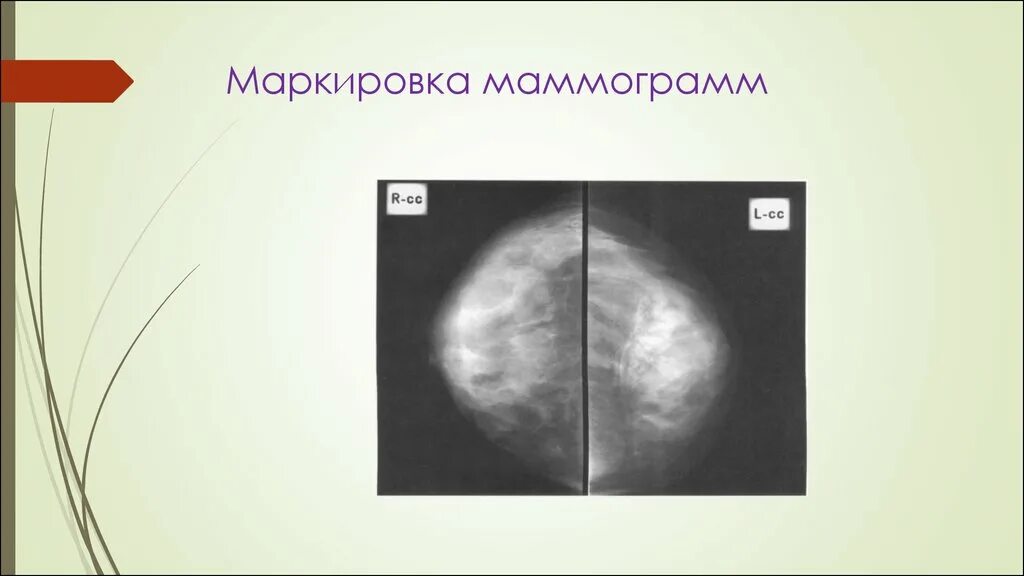 Центр маммограммы