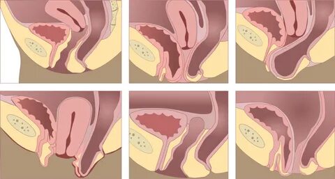 Қысқа шашты жетілген брюнеткалардың порнофотосуреттері