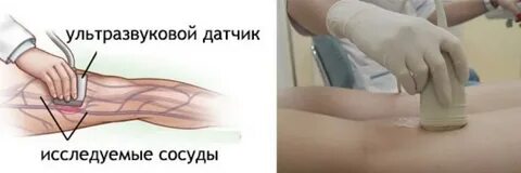 Узи вен для операции