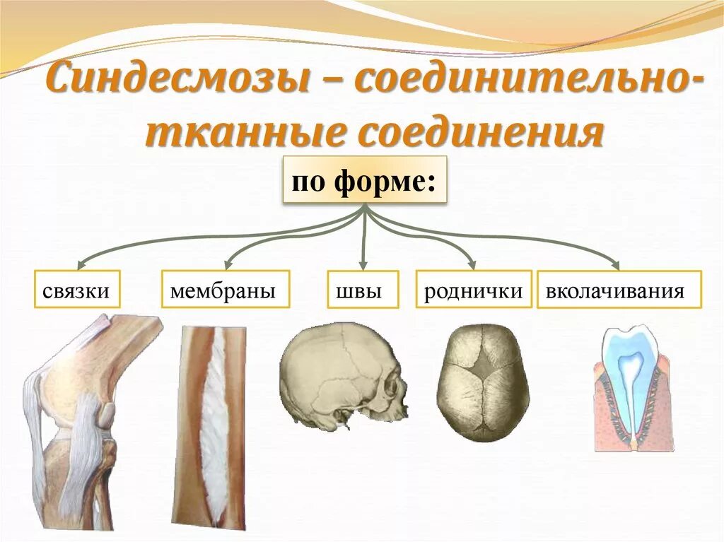 2 соединения костей примеры. Соединение костей синдесмозы. Фиброзные соединения синдесмозы. Синдесмозы связки мембраны швы. Соединения костей синдесмозы фиброзные.