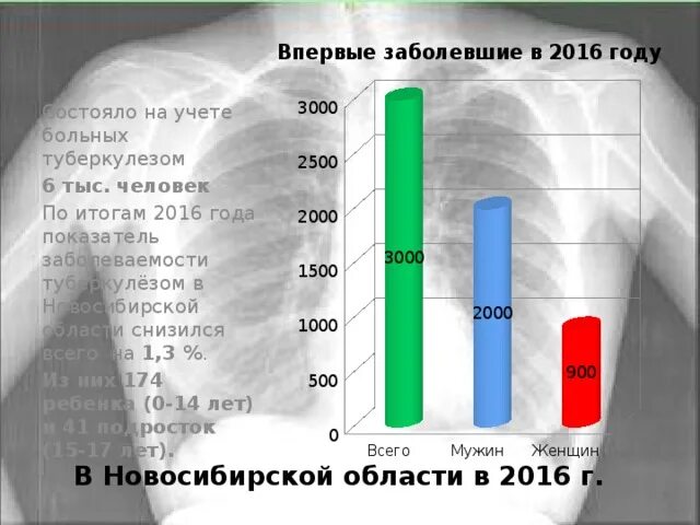 Сколько туберкулеза в россии