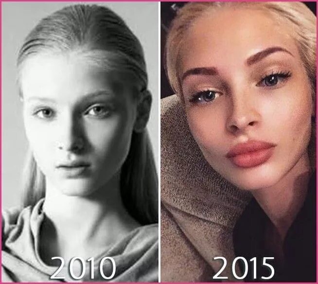 Шишкова фото до и после операции In the media got a new photo of Alena Shishkova without photoshop ! Do you think