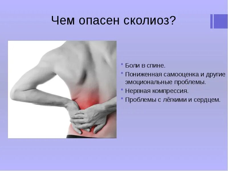 Сколиоз сердца. Может ли из-за сколиоза болеть сердце. болит сердце при сколиозе. колит сердце из за сколиоза.