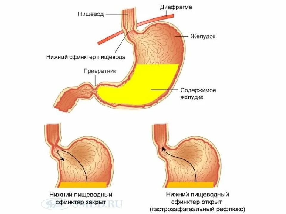 Желчная кислота в желудке.