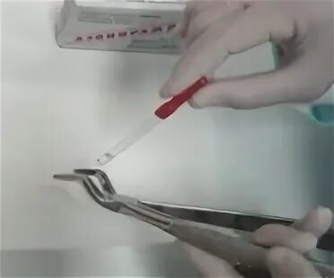 Азопирамовая проба видео