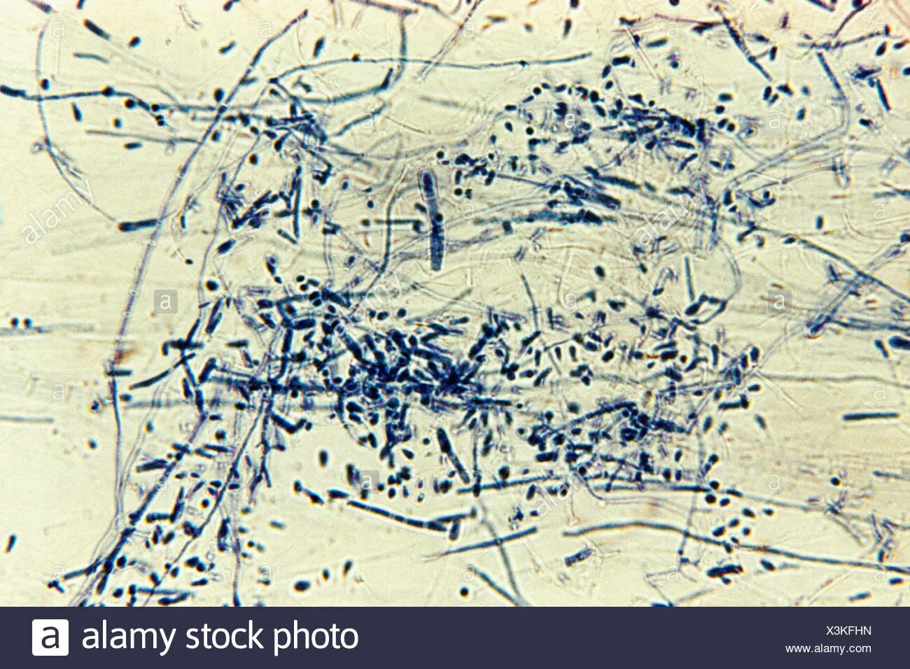 Лептотрикс лечение. Микроскопия Trichophyton rubrum. Лептотрикс микроскопия. Trichophyton tonsurans бактериология.