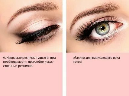 Нависшее веко какой изгиб
