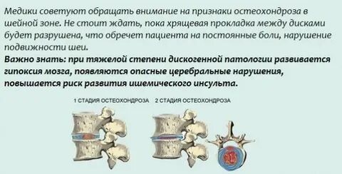 Обострение грудного остеохондроза симптомы у женщин
