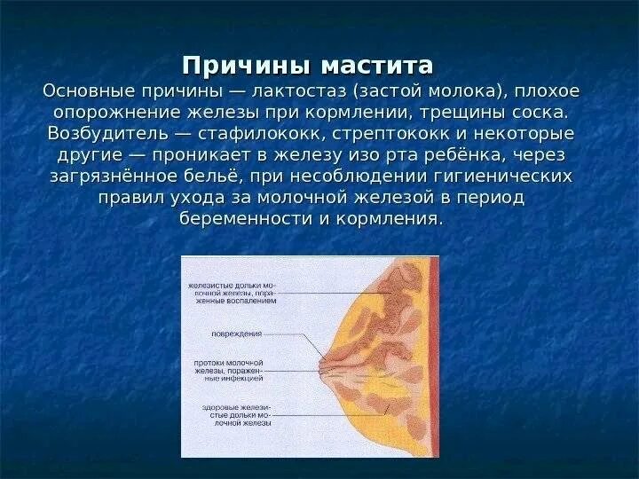 Ощущение молочных желез. Симптомы лактационного мастита. лактостаз молочной железы. застой молока в грудных железах.