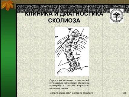 Сколиоз центр