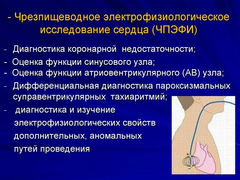 Электрофизиологическое исследование глаз. Электрофизиологическое исследование сердца. электрофизиологическое исследование сердца (эфи). внутрисердечное электрофизиологическое исследование сердца. чреспищеводное эфи сердца.