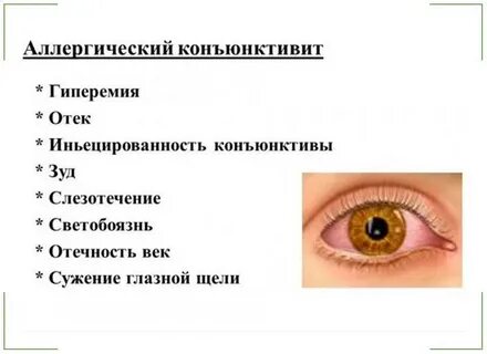 Причины конъюнктивита глаз